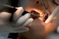 patient with jaw pain at dentist getting treatment