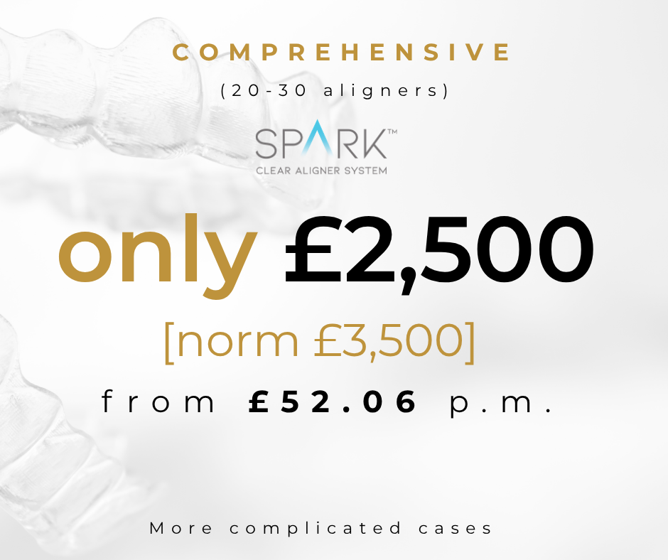Spark Comprehensive Complex aligner price £2500
