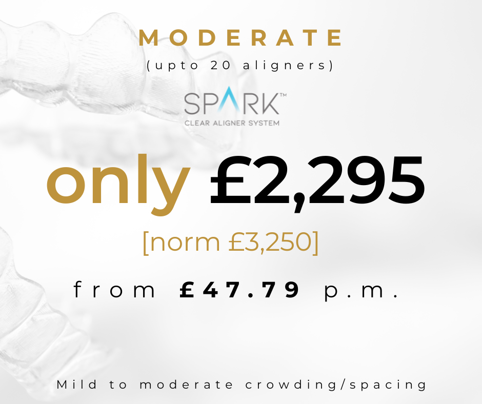 Spark Moderate aligner price £2295