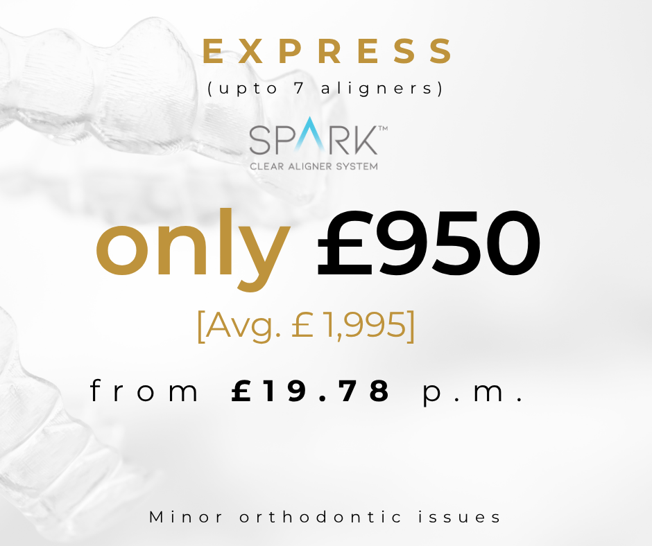 Spark Express aligner price £950